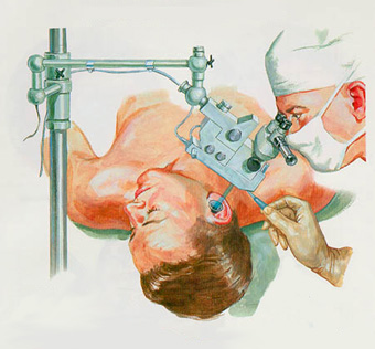 Chirurgie de l’oreille